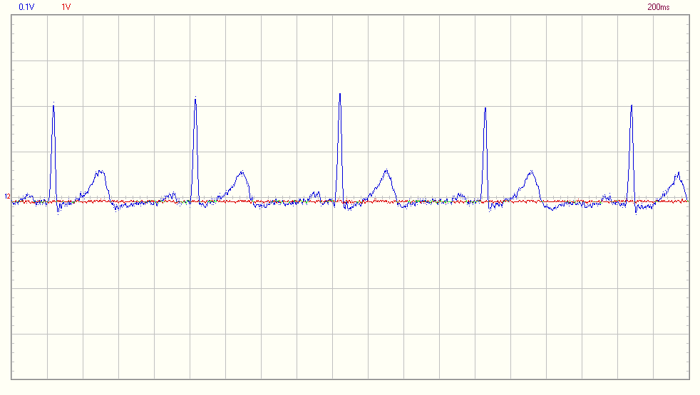 EKG Corina